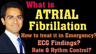 ATRIAL FIBRILLATION (AFIB) TREATMENT, ECG INTERPRETATION, PATHOPHYSIOLOGY, AFIB MANAGEMENT LECTURE