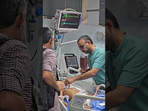يومي تقليدي بدوام بداخل جراحة القلب مستشفى غزة الاوروبي قطاع غزة 