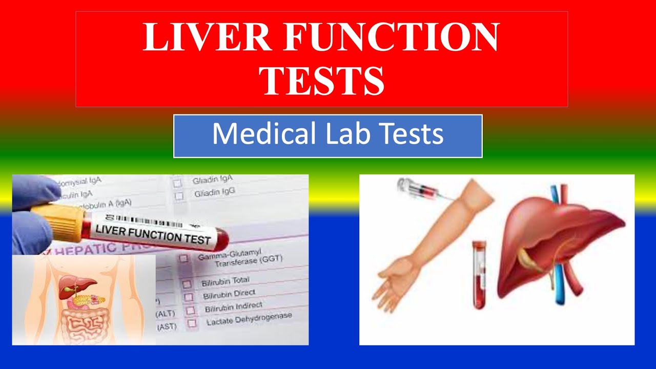 LIVER FUNCTION TESTS - Medical Lab Tests - What is ? , Uses , Need ...