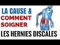 Hernie Discale: Symptomes et Causes Hernie Discale: Symptomes et Causes