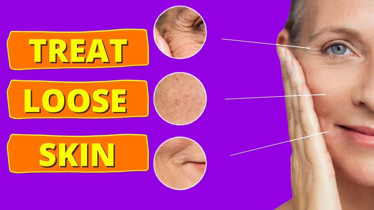Tighten Loose Saggy Skin Home Remedies YouTube Tighten loose saggy skin home remedies youtube