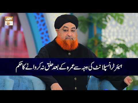 Hair Transplant ki Waja Say Umrah kay Baad Halaq na Krwane ka Hukum? | Mufti Muhammad Akmal