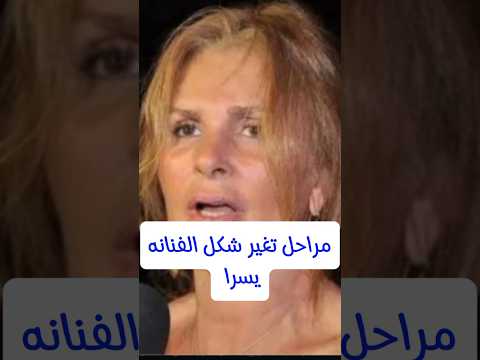 مراحل تغير شكل الفنانه يسرا