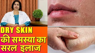 Dry Skin Problem & How To Solve It Simply || सूखी स्किन की समस्या का सरल इलाज