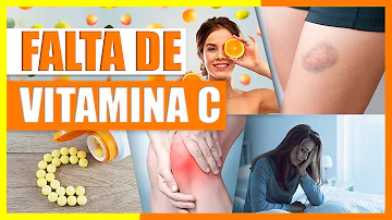 ¿Es buena la vitamina C para combatir el envejecimiento?