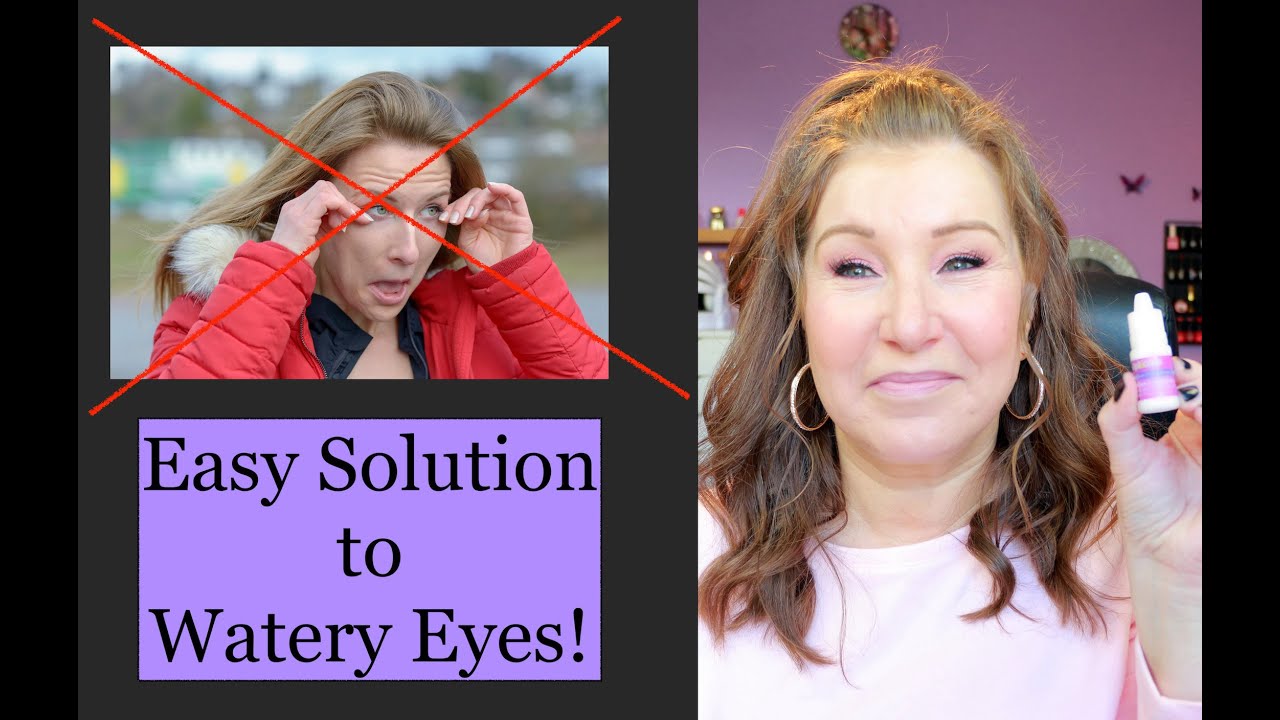 How To Get Rid Of Watery Eyes! - YouTube