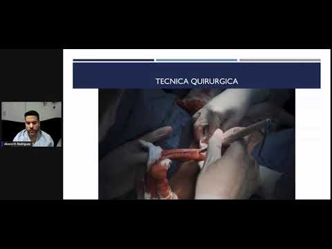 Vídeo: Vaginoplastia: Riesgos De Cirugía De Confirmación De Género Y Recuperación