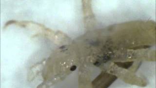 Watch a lice (louse) hatch under a microscope