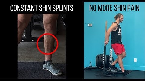 The Complete Guide to Ending Shin Splints: The Video I Wish I Had Years Ago