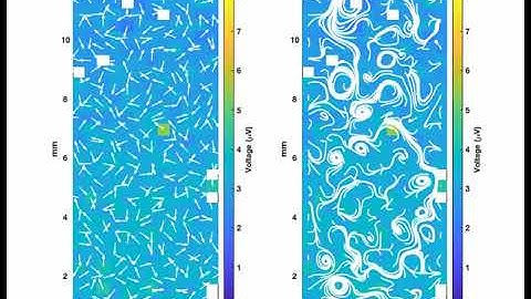 A microelectrode array that provides precise 2D maps of spinal cord electrophysiology during surgery