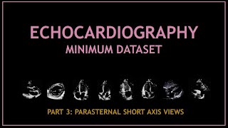 Echocardiogram: Minimum dataset (PART 3: Short axis views)