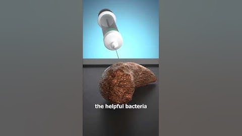 How A Poop Transplant Works 💩🤔