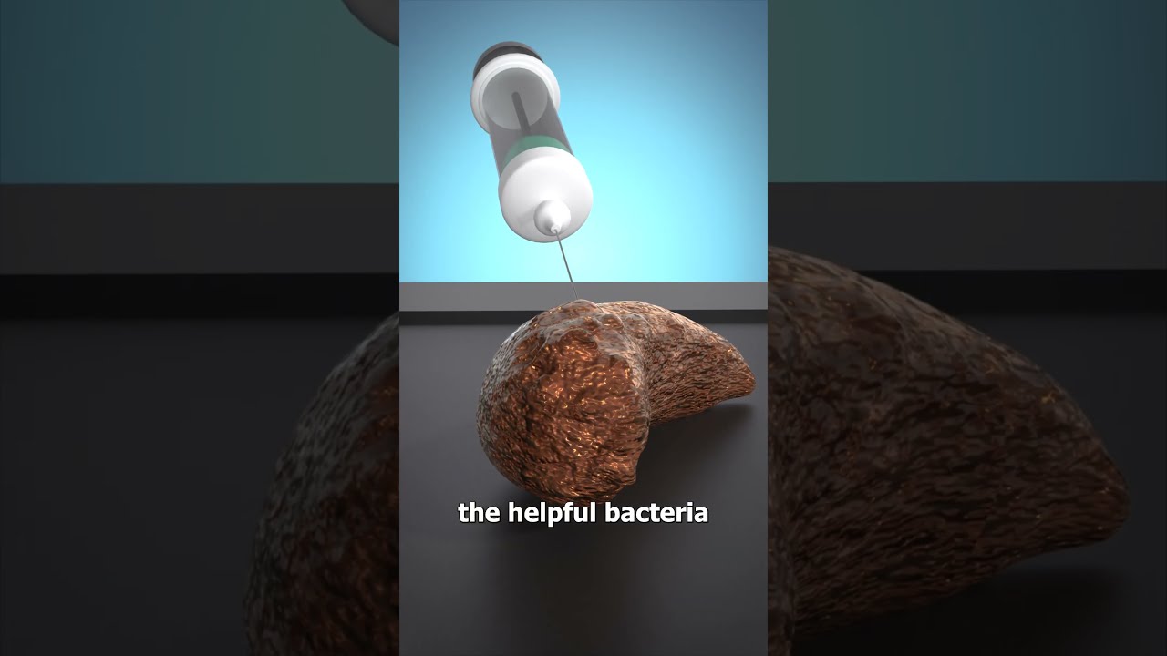 How A Poop Transplant Works 
