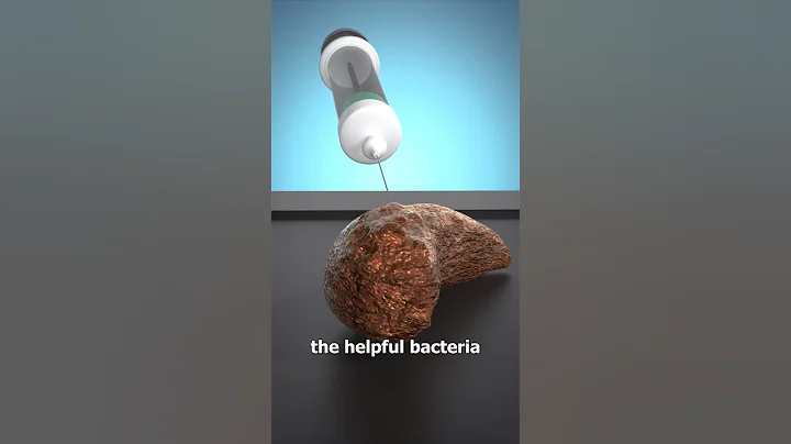 How A Poop Transplant Works 💩🤔