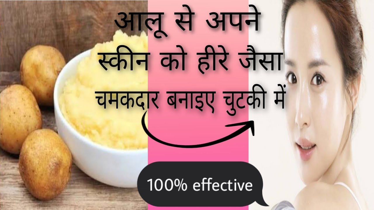 DIY potato mask for pigmentation/ potato face mask for Hyper pigmentation, Acne scars,black spot