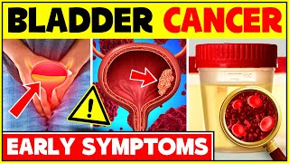 5 Early Signs And Symptoms Of Bladder Cancer | Bladder Cancer Symptoms Male And Female