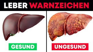 5 Gefhrliche Warnzeichen Deiner Leber