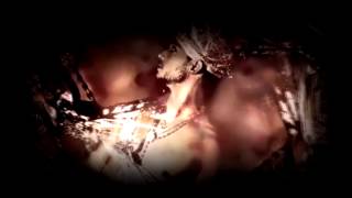 Erick Strong - Out Of My Mind Anthya