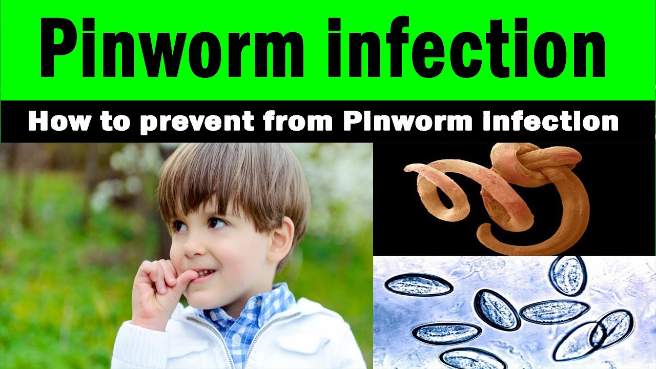 a pinworms élhetnek a hüvelyben