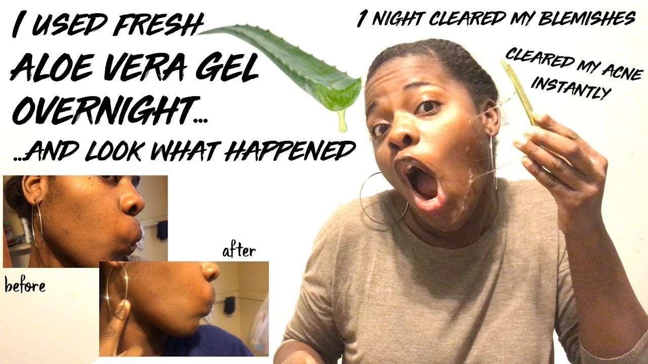 I Used Fresh Aloe Vera Gel Overnight For 1 Night And Look What