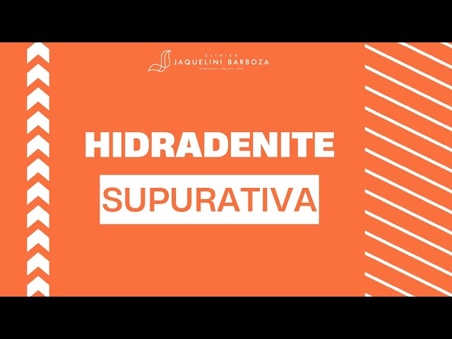 Hidradenite Supurativa