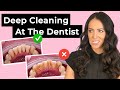 Deep Cleaning at the Dentist
