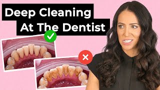 Deep Cleaning at the Dentist