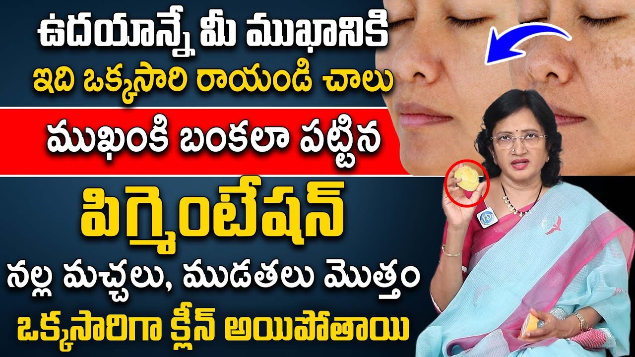 ముఖం పై మచ్చలు పిగ్మెంటేషన్ పోయి నున్నగా మారాలంటే.. | Pigmentation | K Lalitha Reddy | iDream Health