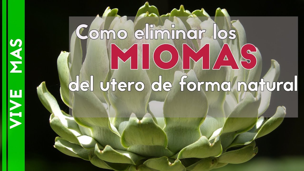 como eliminar los miomas del utero de forma natural - YouTube