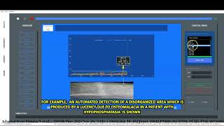 ALIGNOGRAM: A DEVICE TO MEASURE DISORGANISATION (MISARRANGEMENT) OF COMPONENTS. screenshot 4