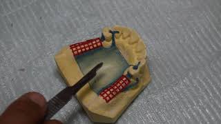 Partial denture technology PRS362 video 4 (Major connectors)