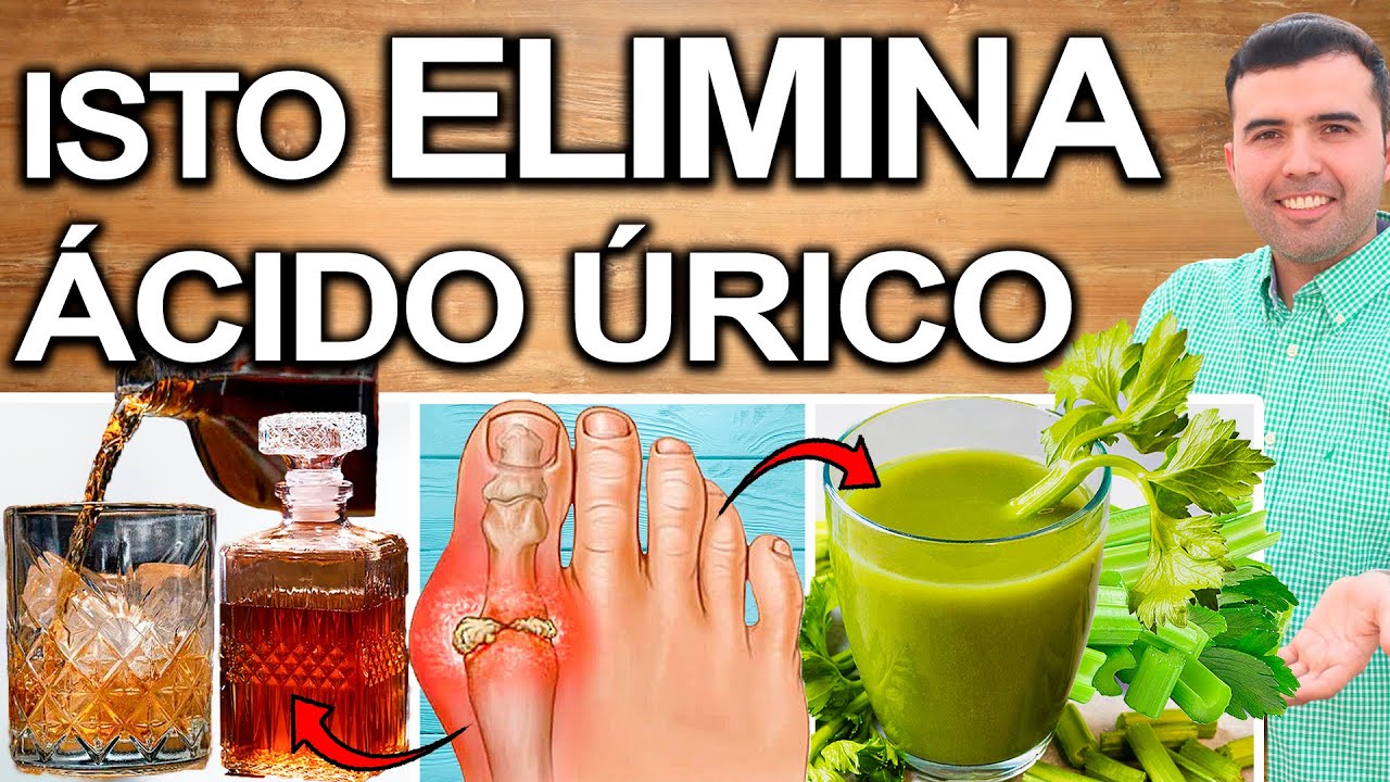 ACABE COM O ÁCIDO ÚRICO 100% EFICAZ! - Como Diminuir O Ácido Úrico ...