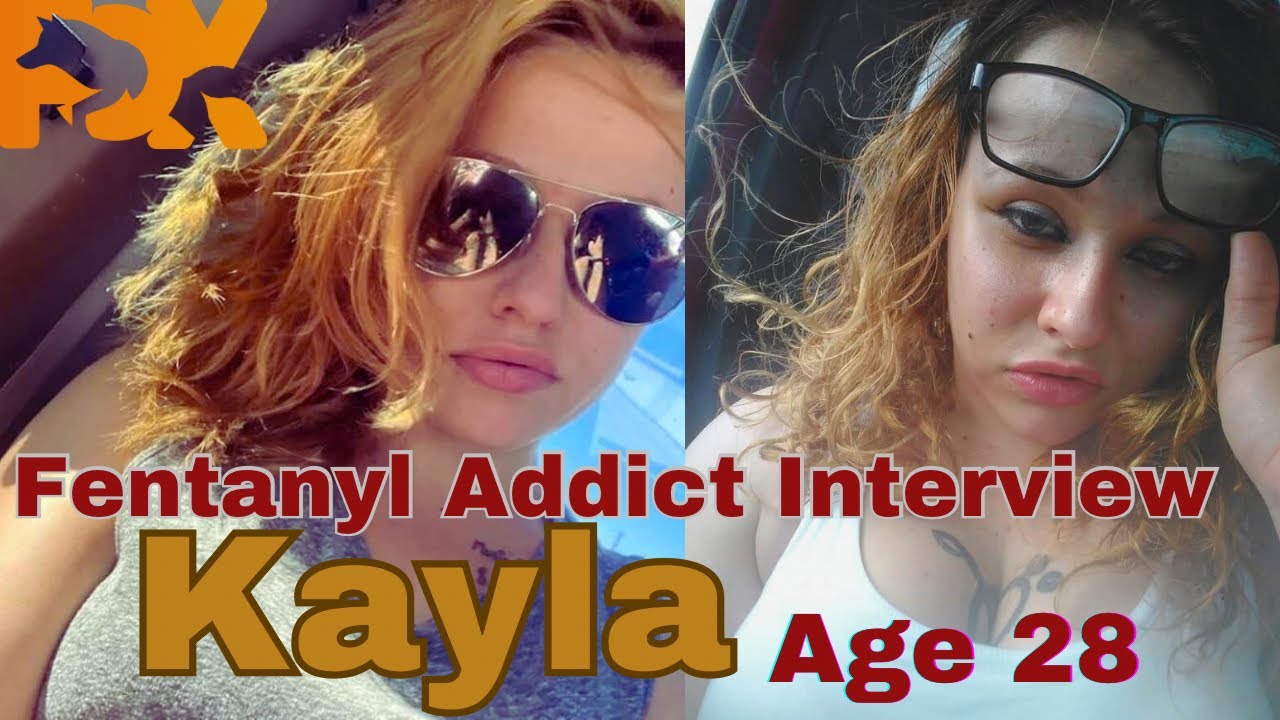 Kayla - “I Been Using Since I Was 16”
