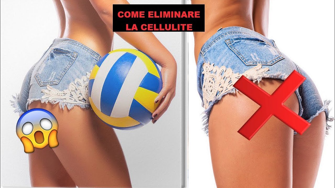 eliminare cellulite