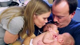 Conjoined Twins Now Independent Toddlers | Cincinnati Childrens