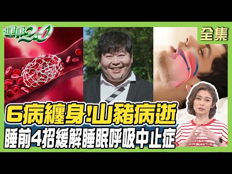 38歲山豬6病纏身 感冒變肺炎併發敗血症逝！緩解睡眠呼吸中止症 睡前10分鐘4招口咽訓練！健康2.0 20240428【完整版】鄭凱云 江秉穎 陳冠任 許聖梅 陳潮宗 彥寬@tvbshealth20