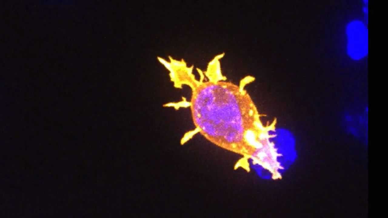 Celulas T atacan a Celulas Asesinas