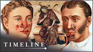 Where Did The Syphilis Pandemic Start? | The Syphilis Enigma | Timeline