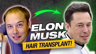 Elon Musk&#39;s INSANE Hair Loss Transformation!