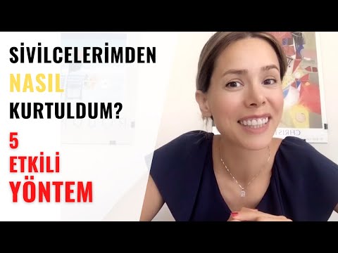 Sivilcelerden Kurtulmanın Yolları | 5 Etkili Çözüm