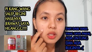 Review PI KANG WANG SALEP - Pengalaman pertama pakai salep ini, ampuhh tuntaskan jerawat