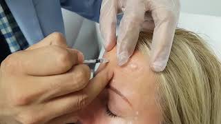 Injections De Вotox Clinique Mariderm Medispa St Jean Sur Richelieu, Montérégie