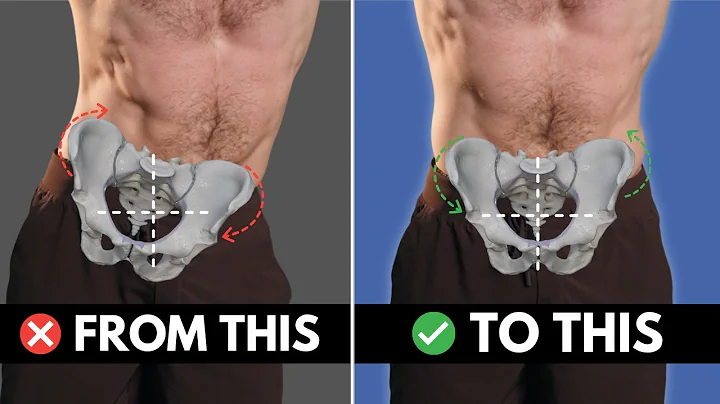 The Game-Changing Method To FIX Uneven Hips (Lateral Pelvic Tilt)