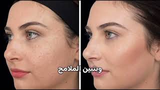 Introduction to the Facial RF device l سر الجمال المثالي