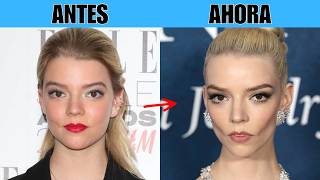 Top 20 Celebridades que quedaron deformadas tras una extracción de grasa bucal | Antes y Ahora 2026