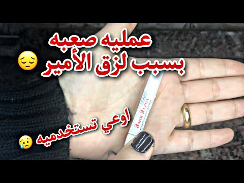 تحذير اوعي تستخدمي لزق الأمير في تركيب الأظافر سببلي كارثه