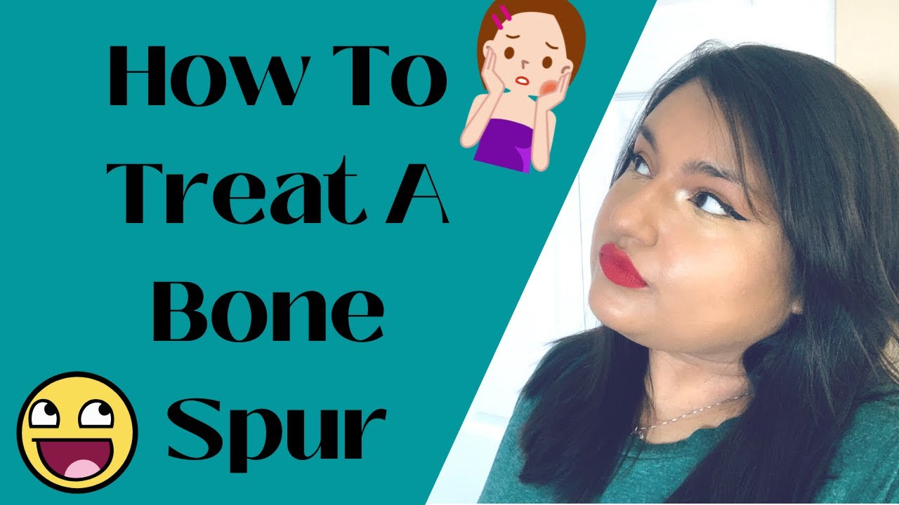 How Do You Treat a Bone Spur? YouTube