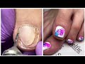 Most Satisfying Pedicure transformation 😱 best nail polish for toes 2021
