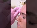Botox Training Course