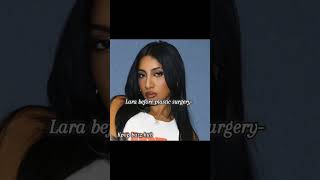 Lara Before Plastic Surgery And After Sorry Lara But..